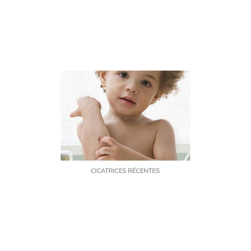 KELO-COTE Spray Silicone