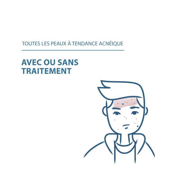 Ducray Keracnyl Gel Moussant – Paramarket.com