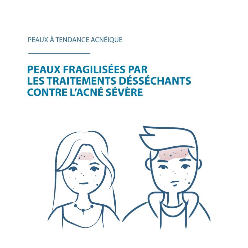 Ducray Keracnyl Repair Crème – Paramarket.com