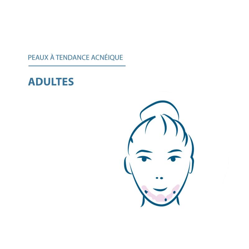 Ducray Keracnyl Sérum anti-imperfections et anti-âge – Paramarket.com