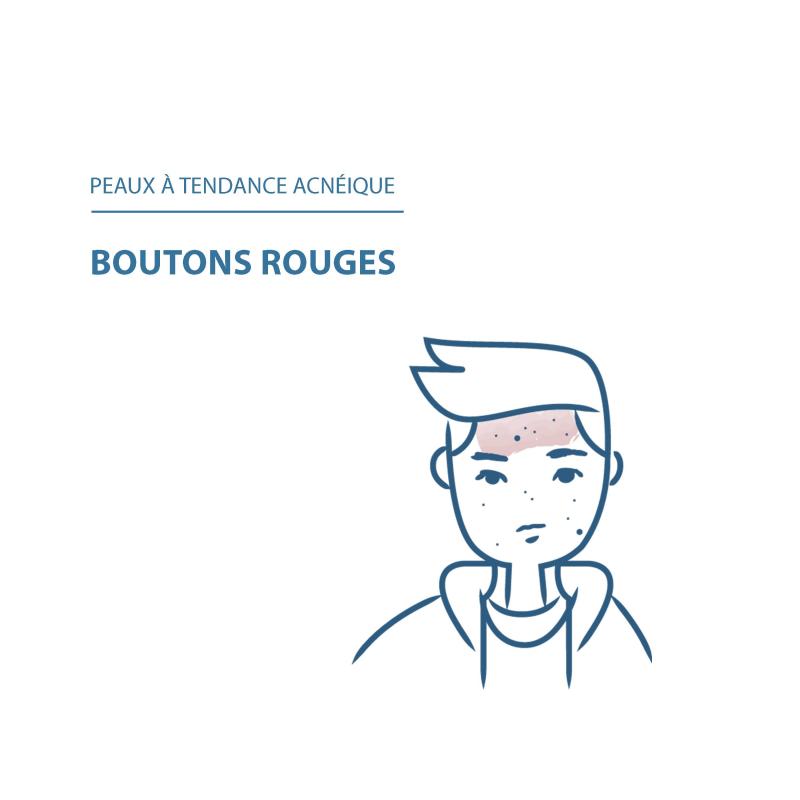 Ducray Keracnyl PP+ Emulsion traitante purifiante – Paramarket.com