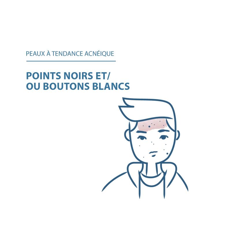 Ducray Keracnyl Glycolic crème désincrustante - Paramarket.com