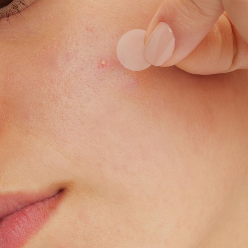 CeraVe Patchs Anti-Imperfections x22 - Paramarket.com