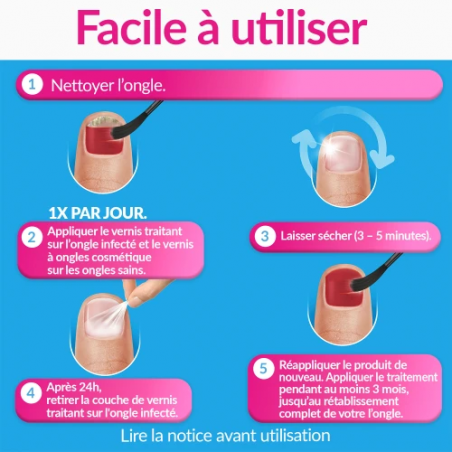 Excilor Forte Traitement Color Rouge – Paramarket.com