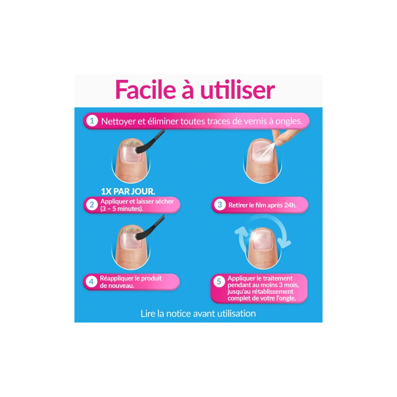 Excilor Forte Traitement de la Mycose de l'Ongle – Paramarket.com