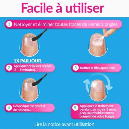 Excilor Forte Traitement de la Mycose de l'Ongle – Paramarket.com Excilor Forte Traitement de la Mycose de l'Ongle – Paramarket.com