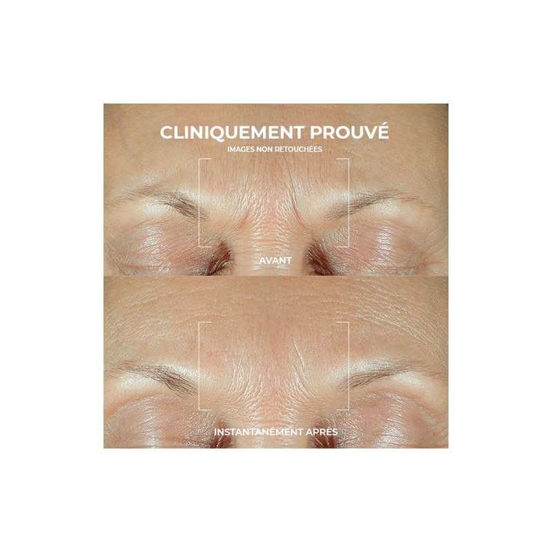 Roc Derm Correxion Sérum Combleur de Rides – Paramarket.com