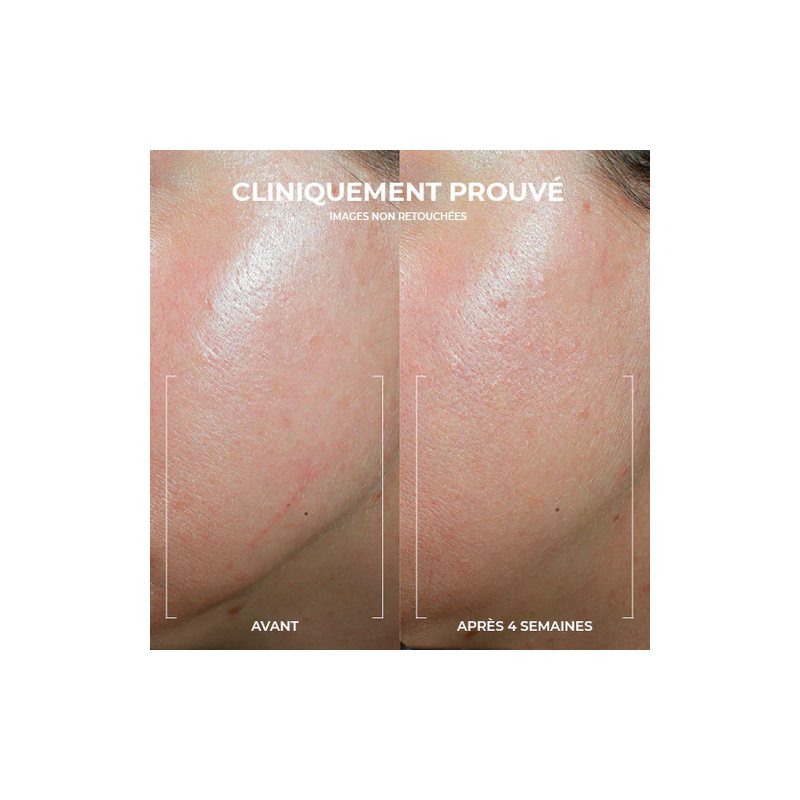 Roc Derm Correxion Crème Contour Ovale – Paramarket.com