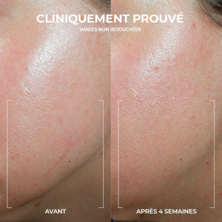Roc Derm Correxion Crème Contour Ovale – Paramarket.com