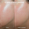 Roc Derm Correxion Crème Contour Ovale – Paramarket.com Roc Derm Correxion Crème Contour Ovale – Paramarket.com