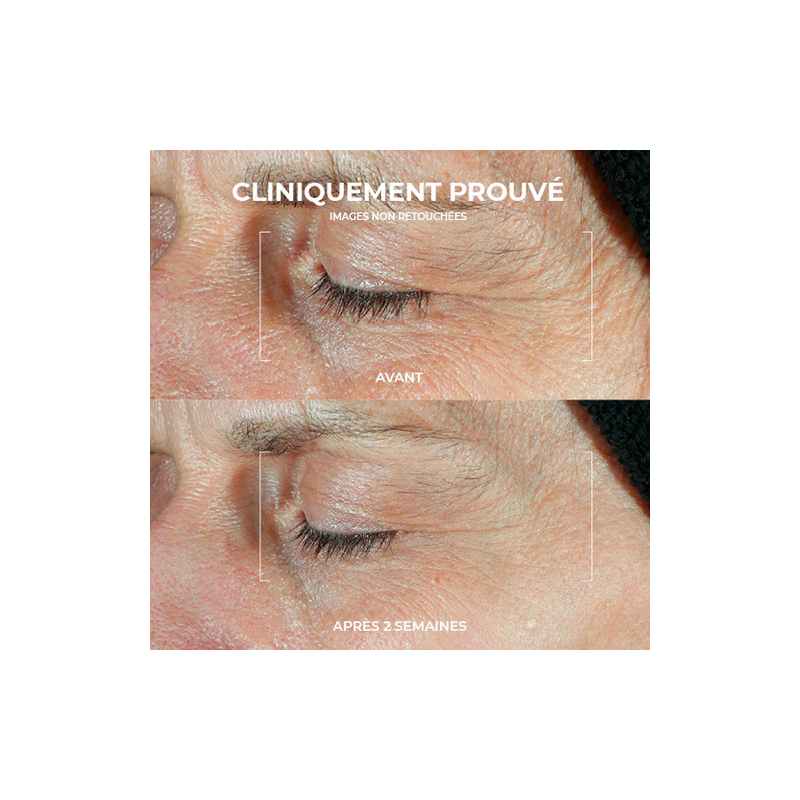 Roc Derm Correxion Contour Yeux Duo Lift – Paramarket.com