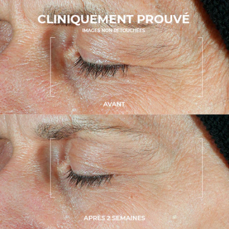 Roc Derm Correxion Contour Yeux Duo Lift – Paramarket.com