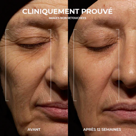 Roc Retinol Correxion Crème rides profondes nuit – Paramarket.com