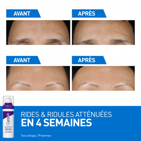 Cerave Skin Renewing Sérum Rétinol - Paramarket.com