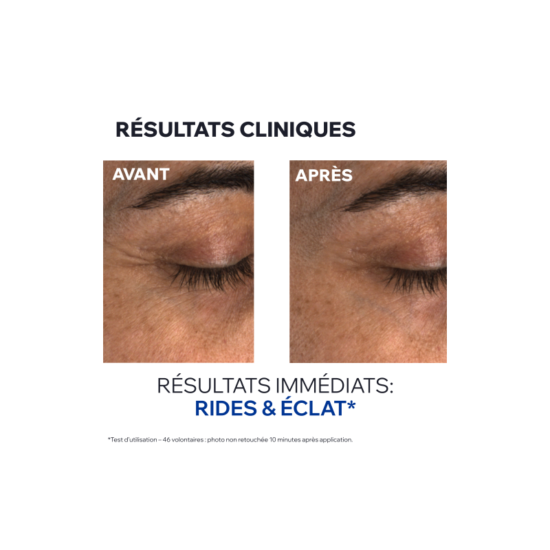 Uriage Age Absolu Baume Regard Flouteur-Redensifiant – Paramarket.com