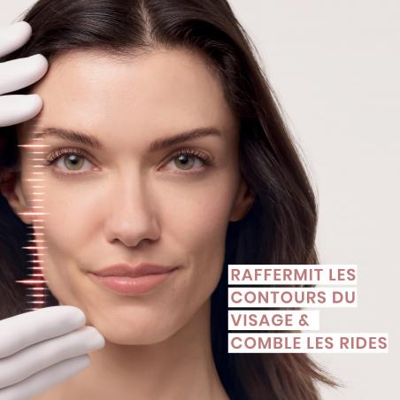 Avène Hyaluron Activ Procedure Crème Micro-Lift Yeux & Lèvres – Paramarket.com