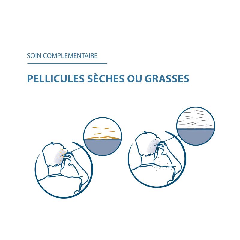 Ducray Squanorm Lotion Anti-pelliculaire au Zinc - Paramarket.com