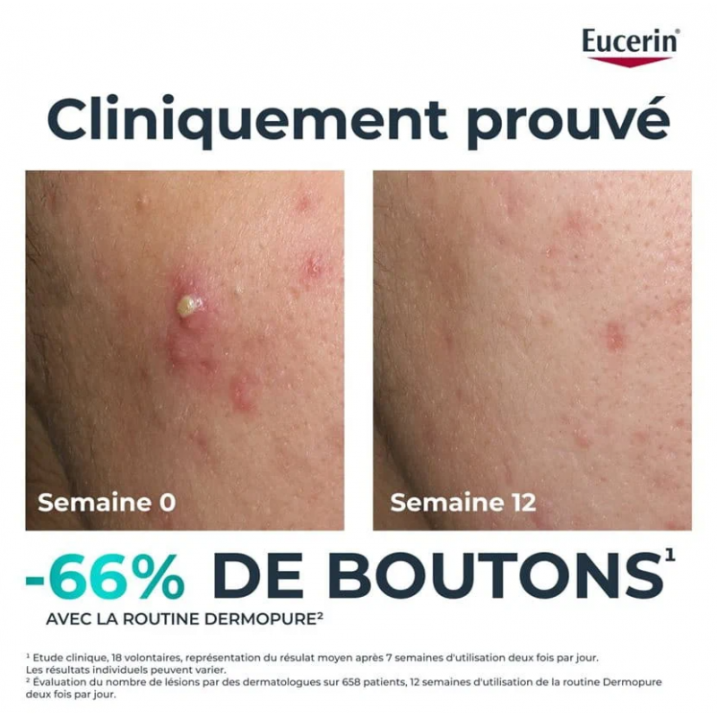 Eucerin Dermopure Clinical triple Action - Paramarket.com