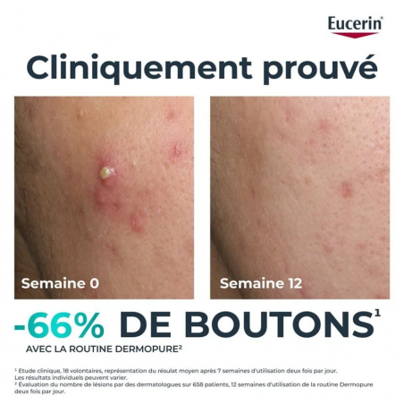 Eucerin Dermopure Clinical triple Action - Paramarket.com