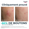 Eucerin Dermopure Clinical triple Action - Paramarket.com