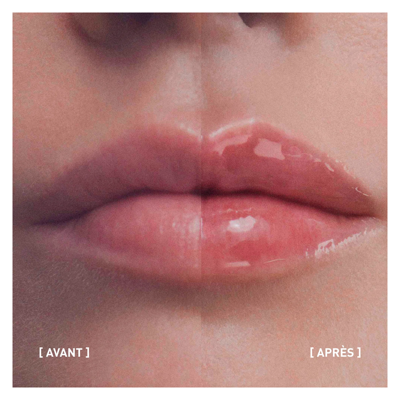 Filorga Hyalu-Filler Lips - Paramarket.com